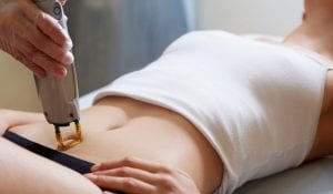 كيف اسوي ليزر لمنطقة البكيني